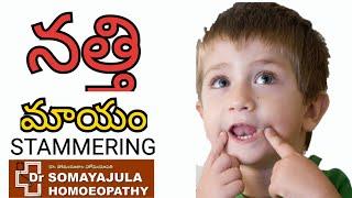 Stammering/ Natti / can be Treated / Dr Suresh Somayajula / Homeopathy