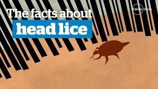 Head lice - the facts