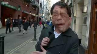 The Ugly Face of Disability Hate Crime  - BBC Documentary