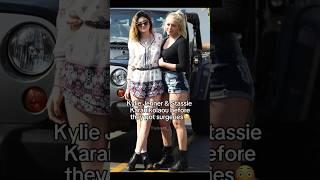 Kylie Jenner & Stassie before they got surgery#kyliejenner #celebrity #goviral #shorts #beautiful