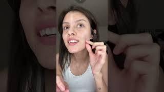 How I rid of pimples overnight | Drying pimple paste