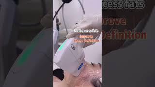 Ultracel Q+ HIFU Skin Firming & Lifting | 超声刀肌肤紧致 | 改善双下巴 | Define Aesthetic Medical Clinic