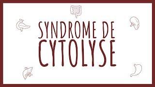 Sémiologie Hépatique - Syndrome de Cytolyse