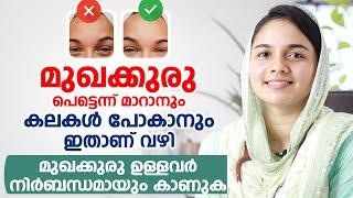 മുഖക്കുരു (Acne, Pimples) പെട്ടെന്ന് മാറാനും കലകൾ പോകാനും ഇതാണ് വഴി