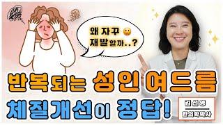 대구 자꾸만 반복되는 성인 여드름 확실한 치료방법은? 성인여드름 학생여드름 청소년여드름 여드름흉터 여드름원인 여드름치료방법 울산포항부산구미안동창원밀양 청담미한의원