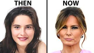 Melania Trump's NEW FACE | Plastic Surgery Analysis