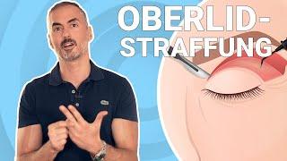 Dein Plastic Surgery Coach - Oberlidstraffung