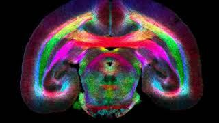 Marmoset brain imaging