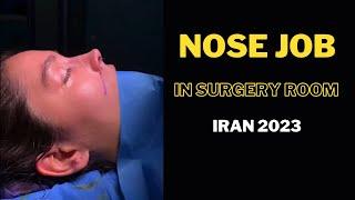 Nosejob Result by Dr. Nouri in the Operating Room