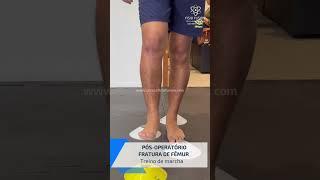 FRATURA FÊMUR #fisioterapia #reabilitação #saude #shorts #sports #exercise #fratura #brasil