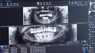 Outstanding Care and Results | Patient Experience at Los Gatos Oral & Facial Surgery