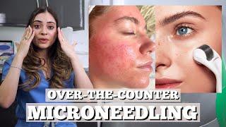 How To Safely Microneedle At Home | Best Mirconeedling Devices by Dr. Somji & Henal Somji