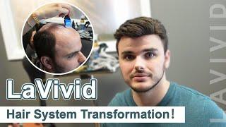 Hair System Transformation| LaVivid Hair System