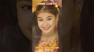 ANNE CURTIS - Then And Now