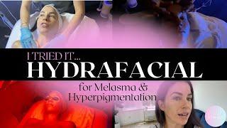 I Tried...the Hydrafacial for Melasma Hyperpigmentation // REBELLE NUTRITION