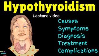 Hypothyroidism (Underactive Thyroid): Causes, Symptoms, Diagnosis, Treatment, Complications