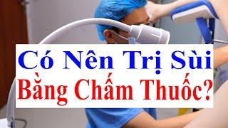 Mắc Sùi Mào Gà Có Nên Điều Trị Bằng Chấm Thuốc Không? - Thực Hiện Đốt Sùi Mào Gà Bằng Dao Điện