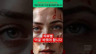 피부가 안 낫는 진짜 이유… 약이 아니라 ‘이것’을 바꿔야 합니다 #건강 #건강정보
