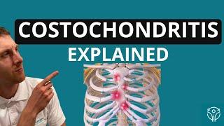 Costochondritis (Rib Inflammation): Definition, Causes, Symptoms, Recovery | Aleks Physio