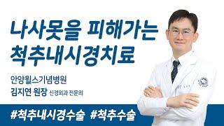 나사못을 피해가는 척추내시경 치료 (안양윌스기념병원 신경외과 김지연)