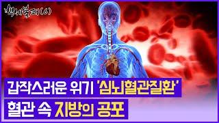 소리 없이 시작된 삶의 위기, 심뇌혈관질환!  한번 퍼지면 회복되지 않는 후유증을 남긴다/혈관 속 지방의 공포/경인TV 백세불패 20220525