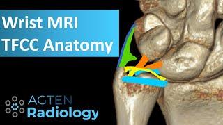 MRI Anatomy of TFCC