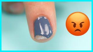 PREVENT UGLY Chipped Nails / Suzie’s Pro Education