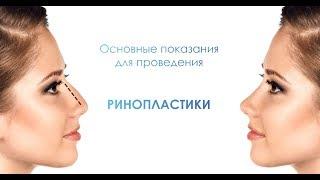 Красивый нос - кому нужна ринопластика?  Пластический хирург Свиридов Максим Константинович