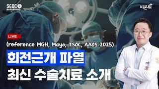 [ 비온뒤 X 삼성글로벌정형외과 ]  회전근개 최신 수술법. 2025 -조광석 대표원장 #대구정형외과 #비온뒤 #비온뒤의학채널 #회전근개파열 #대구어깨수술