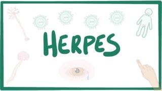 Herpes (oral & genital) - causes, symptoms, diagnosis, treatment, pathology