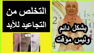 ١- كيفية التخلص من التجاعيد في الوجه و الخطوط الرفيعة / ما لا تعرفه عن البشرة و الوقاية من التجاعيد