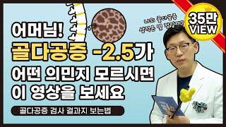 힘내쇼 46화 나의 골다공증 성적은 몇 점일까요? 골다공증검사 결과 보는법 어렵지 않아요!