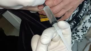 укол в ягодицу малышу. butt injection to child. укол, уколы, укол детям