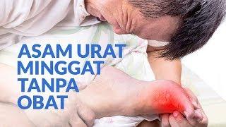 Cara Alami Menurunkan Asam Urat Yang Dianjurkan Dokter