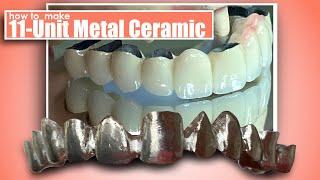 How to Make an 11-Unit Metal Ceramic Restoration