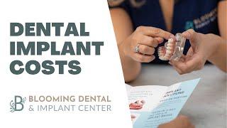 Why Are Dental Implants Or Full Arch Dental Implants So Expensive?