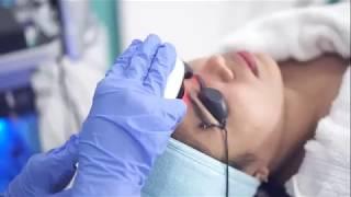 Everything you need to know about HydraFacial MD Elite | Halcyon Medical Centre