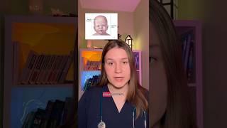 Гели для прорезывания зубов. #дети #детскоездоровье #новорожденный