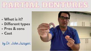 Partial Dentures: Pros & Cons + Cost + Different Types