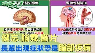 健忘.腦霧.斷片 長輩出現這些症狀恐是腦部疾病 健康2.0