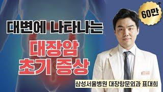 대변에 나타나는 대장암 초기 증상 / 삼성서울병원 대장항문외과 표대희