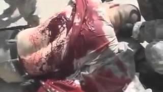 US.SOLDIER COMBAT FOOTAGE,  WOUNDED BY TALIBAN SNIPER**GRAPHIC CONTENT 18+**