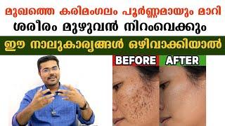 ശരീരത്തിലെ സകല പാടുകളും  മാഞ്ഞുപോകും ഈ നാല് സാധനങ്ങൾ ഒഴിവാക്കിയാൽ  /Dr Manoj Johnson