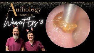 SUBSCRIBERS STICKY EAR WAX REMOVAL - WAXVENT 21