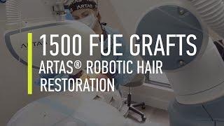 Hair transplant. ARTAS Robotic Hair Restoration in Hair By Dr. Max, Fort Lauderdale, Florida.