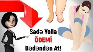 Şişkinliyi Və Ödemi BU YOLLA Aradan Qaldır!