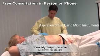 Kristen R. Testimonial Smart Lipo, Abdominal and Chin Liposuction at MyShape Lipo