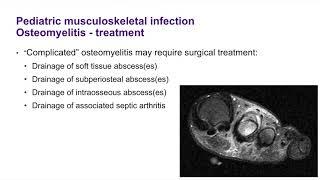 Musculoskeletal Infection in the Pediatric Patient - ABOS Orthopedic Surgery Board Exam Review