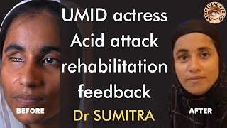 UMID actress' life is now transformed with artificial eye | Dr Sumitra