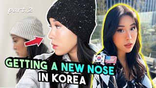 NOSE JOB REVEAL.... | plastic surgery in korea